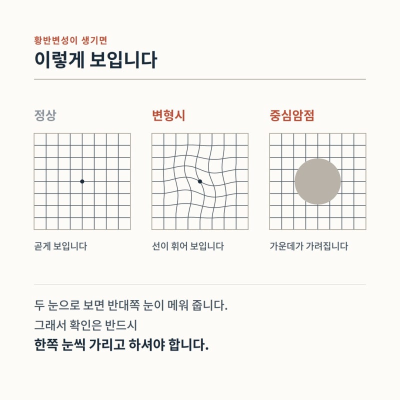 หากมองเห็นวงกบประตูหรือแนวยาแนวกระเบื้องบิดเบี้ยว — เช็กง่ายๆ ที่บ้านใน 30 วินาที โดยปิดตาทีละข้าง 사진 3