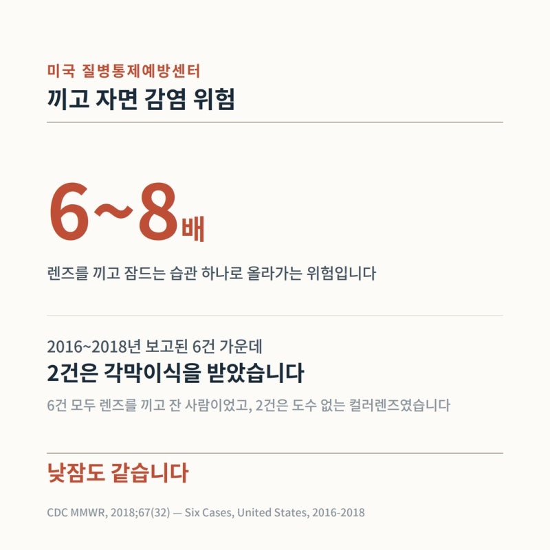 콘택트렌즈 끼고 잠들었다면 — 각막염 경고 증상과 바로 병원에 와야 하는 기준