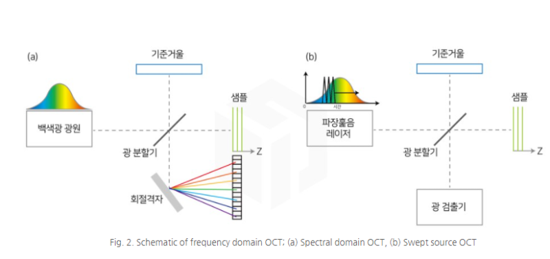 성모 진안과 최고급 황반 망막 검사장비 기사가 뉴스에?! feat. OCT TOPCON DRI TRITON